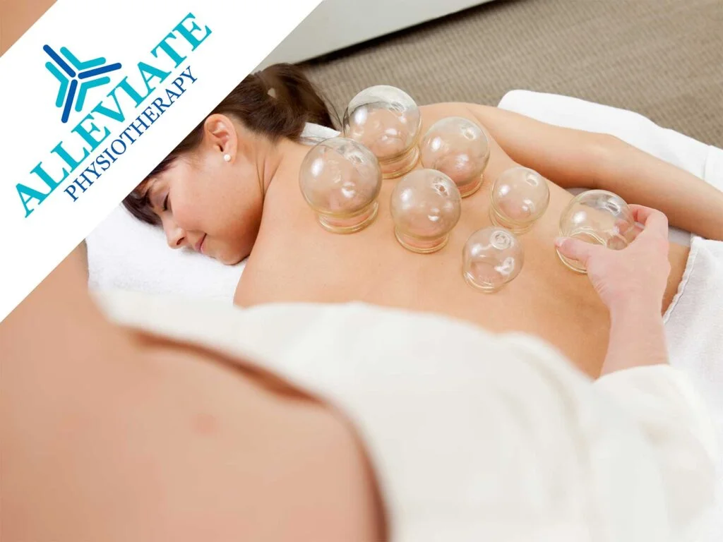 cupping-dry-suction-detox-rejuvination-physiotherapy-Etobicoke-Mississauga-Oakville