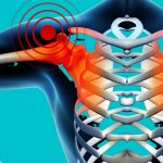 Shoulder-pain-etobicoke-mississauga-physiotherapy