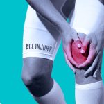 acl-injury-knee-pain-physiotherapy-etobicoke-mississauga-toronto-running-injury-1