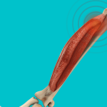 Biceps tendonitis-biceps-tendonitis-injury-rehabilitation-mississauga