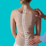 scoliosis-spine-backpain-etobicoke-physiotherapy-mississauga