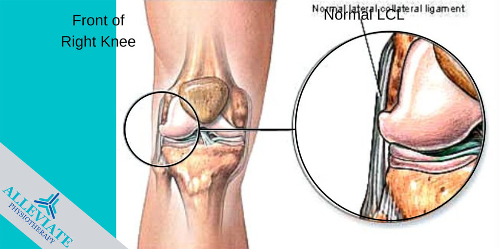 LCL Injury Alleviate Physiotherapy for Quick Recovery