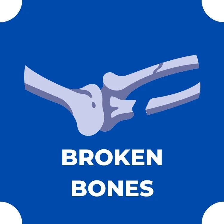 Broken Bones