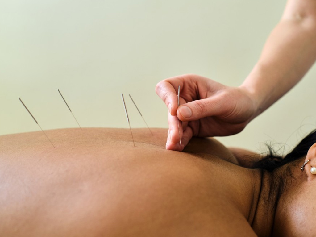 Traditional Chinese Acupuncture