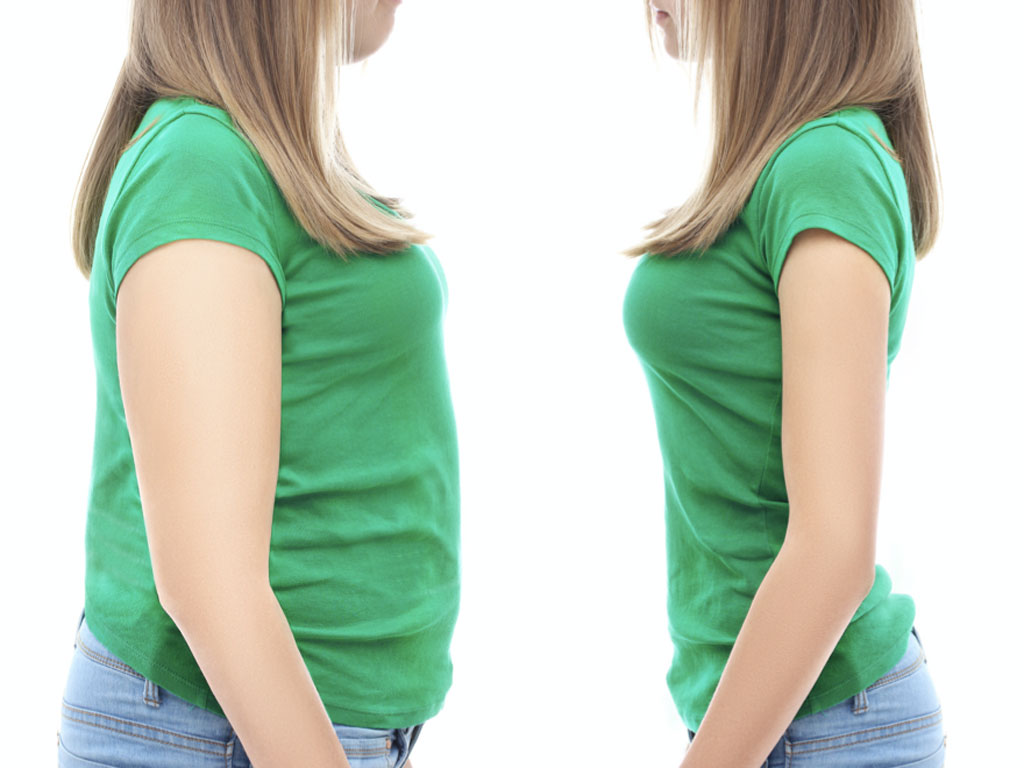 Acupuncture for Weight Loss