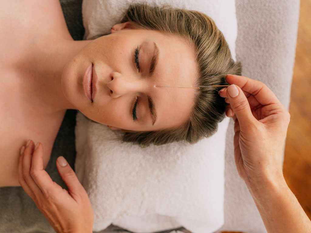 Facial Acupuncture