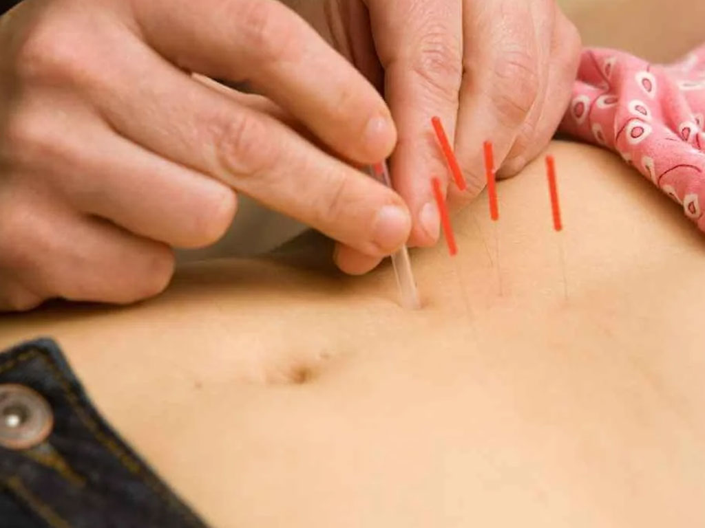 Acupuncture for Constipation