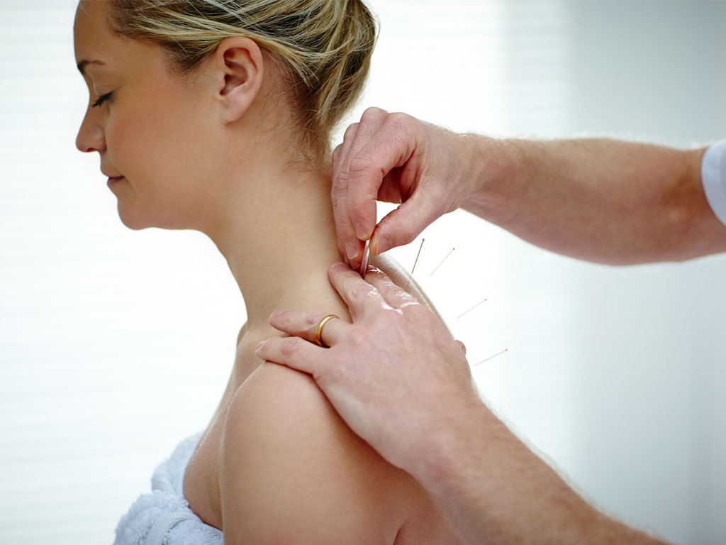 Acupuncture for Fertility