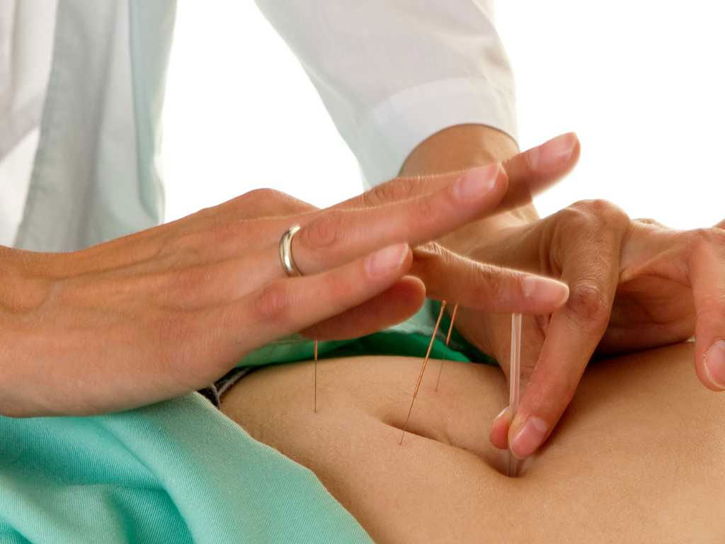 Acupuncture for Fibroids