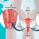 Dyspareunia-pelvic-health-womens-health-physiotherapy-etobicoke-mississauga