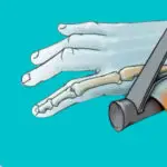 skier_sthumb-skiiaccident-skiaccident-thumbpain-wrist-treatment-mississauga-etobicoke-clarkson